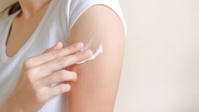 Jenis-Jenis Obat Panu yang Tersedia di Apotik